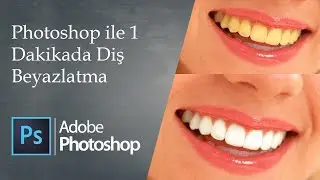 Photoshop ile 1 Dakikada Diş Beyazlatma