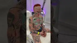 Дед поясняет за тату в клинике Sokolov Laser