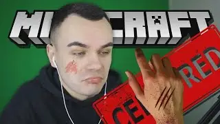 ЯРИК ЛАПА СЛОМАЛ РУКУ! ШОК!! ЯРИК ЛАПА ЧУТЬ НЕ УМЕР🥺