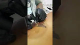 Удаление тату в Sokolov Laser