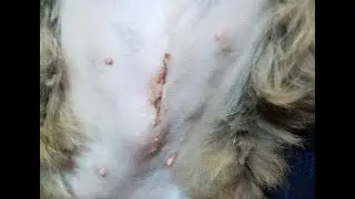 Шишка после стерилизации 2 часть видео