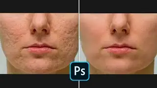 Skin Retouching Tutorial - Photoshop