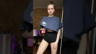 СИНИЕ РАСТЯЖКИ ПО ВСЕМУ ТЕЛУ 😳 как избавилась? 