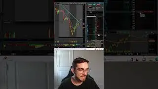 FASTEST Way To Set A Stop-Loss ThinkorSwim 