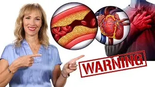 Warning! 8 Signs Your Heart, Arteries Are Clogged | Dr. Janine