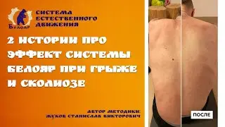 2 истории, как Белояр помог избавиться от грыжи и помогает исправить многолетний сколиоз