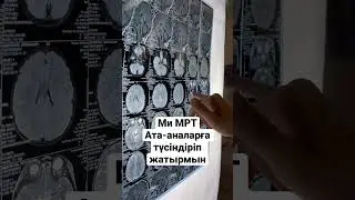 Ми МРТ