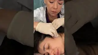 Asmr scalp tingles #asmr #asmrsounds #asmrvideo #relax #relaxing #satisfying #hair #sleep #tingles