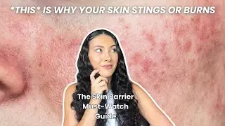 Signs of Damaged Skin Barrier Youre Probably Ignoring