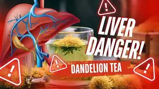 Dandelion Tea: Friend or Foe to Your Liver