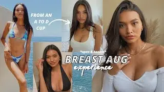 Why I got a breast aug... My Journey/Experience (5 MONTHS POST OP) | NICOLE ELISE
