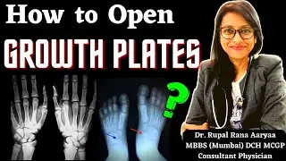 How to OPEN GROWTH PLATES ? बंद GROWTH PLATES को कैसे खोलें ? Open Growth Plates for Height Growth