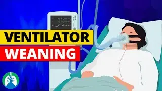 Weaning from Mechanical Ventilation | Criteria and Parameters