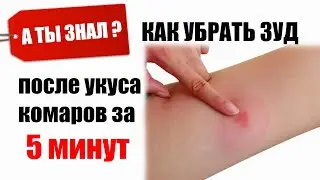 Как убрать зуд после Укуса комара за 5 минут