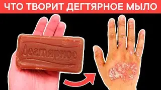 Вот что творит ДЕГТЯРНОЕ МЫЛО с телом! 90% пользующихся НЕ ЗНАЮТ об этом!