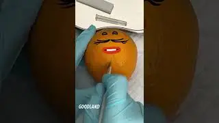 Goodland |Operation on orange 😂