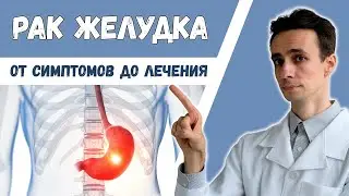 РАК ЖЕЛУДКА 🦀 Симптомы и признаки. Кто в группе риска. Как выявить и лечить.