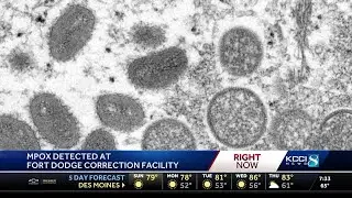 M-Pox detected at Fort Dodge Correctional Facility