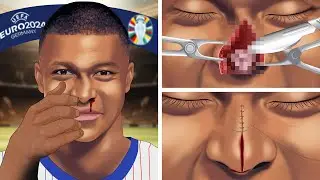 [ASMR] Help Kylian Mbappé his nose injury during Euro 2024