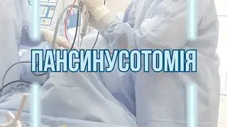 Пансинусотомія. ЛОР хірург в Києві. ЛОР клініка.