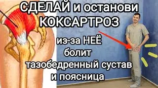 Сделай и останови КОКСАРТРОЗ / из-за этой мышцы болит тазобедренный сустав и поясница + перекос таза
