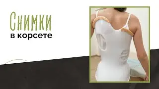 Про снимки в корсете и ортезные предприятия