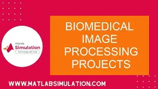 Biomedical Image Processing Projects | Biomedical Image Processing using Matlab Projects