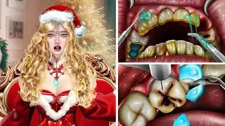 ASMR Female christmas eve santa - Treatment of tooth decay caused by eating a lot of candy