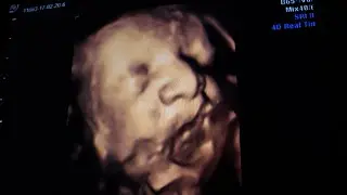 Dad Recognizes Baby's Face In Ultrasound, Learns Mom Lied