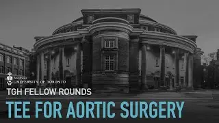 TGH APTE - TEE for Aortic Surgery, Coimbatore Srinivas
