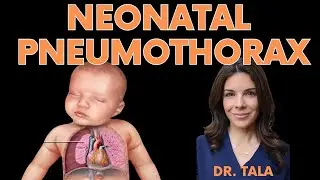 How do you DIAGNOSE and TREAT a newborn's PNEUMOTHORAX??!