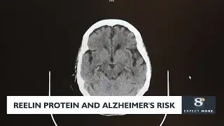 Reelin protein and Alzheimer's risk