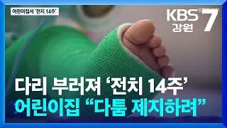 생후 30개월 다리 부러져 ‘전치 14주’…어린이집 “다툼 제지하려” / KBS  2024.11.11.