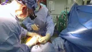 Minimally Invasive Bypass: A Better Way. Sanger Heart & Vascular Institute