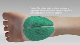Avance Solo - Paddenstoeltechniek