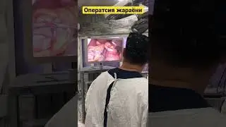 Оператсия жараёни ✂️