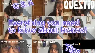 EVERYTHING YOU NEED TO KNOW ABOUT BRACES! Q & A, tips and tricks, bad habits to avoid, etc…