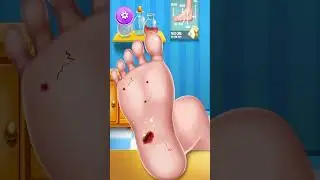 ASMR Mencabut Duri & P4ku Pada K4ki 