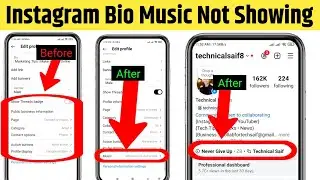 Instagram Bio Music Not Showing | Instagram Profile Music Not Showing | Instagram Profile Music