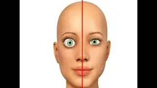 Pathophysiology of Graves Disease