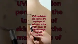 What's the deal with UV?