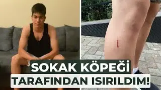SOKAK KÖPEĞİ TARAFINDAN ISIRILDIM!