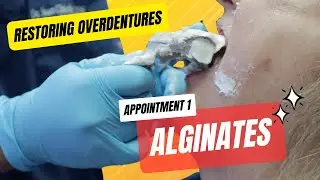 Restoring Implant Overdentures: Alginate Impressions