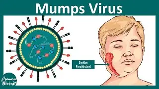 Mumps | Mumps virus | Pathology, diagnosis and treatment