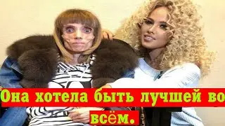 Помните девушку из передачи Малахова, которая весила 17 кг? Что с ней стало сегодня спустя 6 лет.