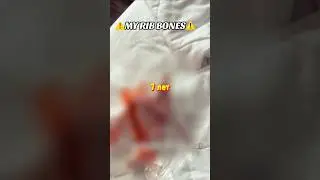 😱 Модель Удалила Рёбра, Чтобы Сделать КОРОНУ