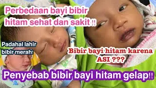 PENYEBAB BIBIR BAYI HITAM GELAP. BIBIR BAYI HITAM KARENA ASI? BEDA BIBIR HITAM SEHAT DAN SAKIT