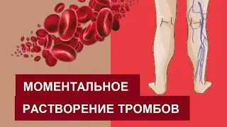 Эти 7 продуктов против ТРОМБЫ в сосудах
