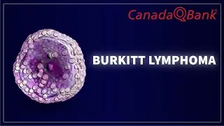 Burkitt Lymphoma