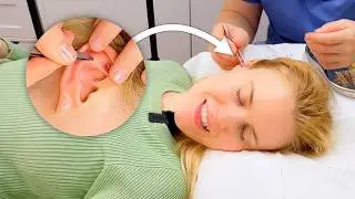 ASMR Ear seeds with acupressure points (Unintentional ASMR, real person ASMR)